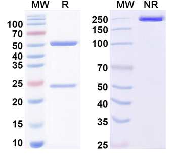 FMDV Genome polyprotein Human Monoclonal Antibody
