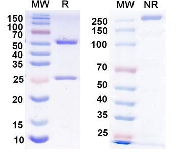 FMDV Capsid protein VP1 Human Monoclonal Antibody