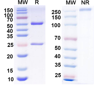 FMDV Capsid protein VP1 Human Monoclonal Antibody