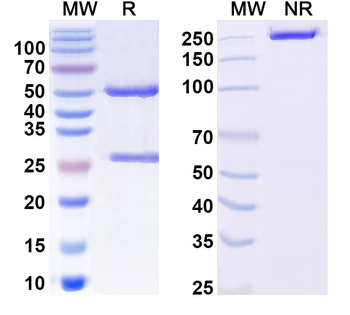 FMDV Capsid protein VP1 Human Monoclonal Antibody
