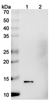Vaccinia virus/VACV A27L Human Monoclonal Antibody