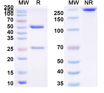K48-linked Polyubiquitin Mouse Monoclonal Antibody