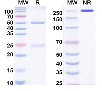 TIMP1 Mouse Monoclonal Antibody