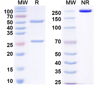 EBV/HHV-4 LMP1/BNLF1 Human Monoclonal Antibody