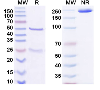 HCV NS1/gp68/gp70/Envelope glycoprotein E2 Human Monoclonal Antibody