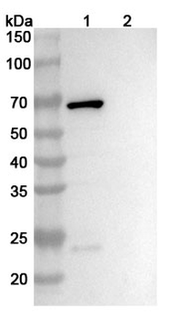 Corynephage omega DT/Diphtheria toxin Mouse Monoclonal Antibody