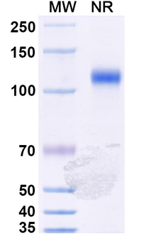 VSV NP/Nucleoprotein Human Monoclonal Antibody