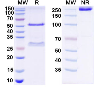 HCV NS1/gp68/gp70/Envelope glycoprotein E2 Human Monoclonal Antibody