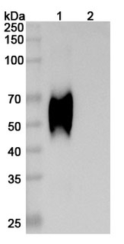 HCV NS1/gp68/gp70/Envelope glycoprotein E2 Human Monoclonal Antibody