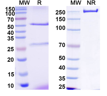 HCV NS1/gp68/gp70/Envelope glycoprotein E2 Human Monoclonal Antibody