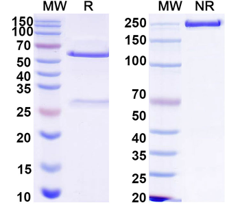 HCV NS1/gp68/gp70/Envelope glycoprotein E2 Human Monoclonal Antibody