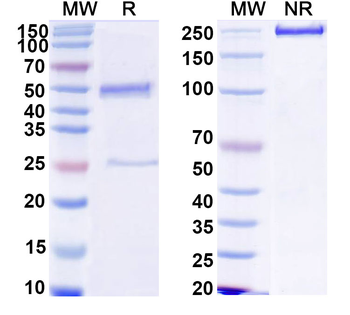 HCV NS1/gp68/gp70/Envelope glycoprotein E2 Human Monoclonal Antibody
