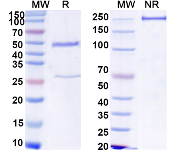 HCV NS1/gp68/gp70/Envelope glycoprotein E2 Human Monoclonal Antibody
