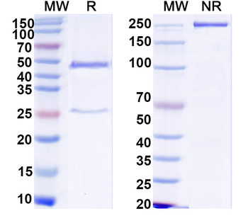 HCV NS1/gp68/gp70/Envelope glycoprotein E2 Human Monoclonal Antibody