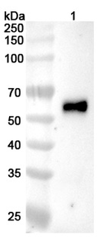 LASV GPC Human Monoclonal Antibody