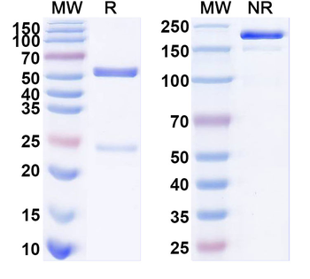 SARS-CoV-2 S Protein Human Monoclonal Antibody