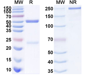 SARS-CoV-2 S Protein Human Monoclonal Antibody