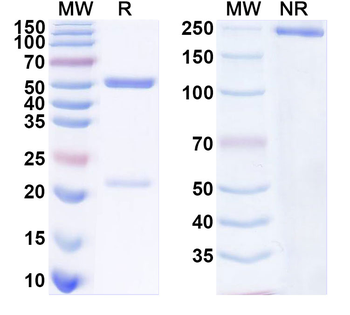 SARS-CoV-2 S Protein Human Monoclonal Antibody