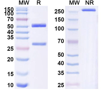 IL1RL1/ST2 Human Monoclonal Antibody