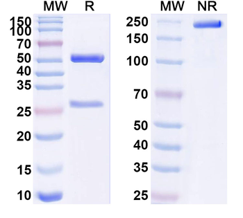 IL1RL1/ST2 Human Monoclonal Antibody