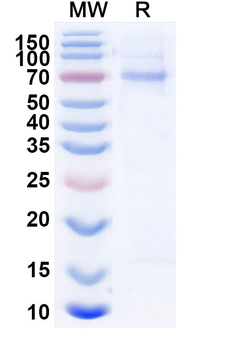 Recombinant Influenza A virus (H3N2) NP/Nucleoprotein Protein, C-His
