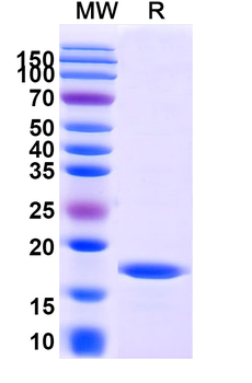 Recombinant SARS-CoV-2 M Protein, N-His
