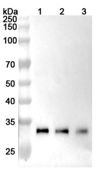 Recombinant Human CTSB Protein, N-His