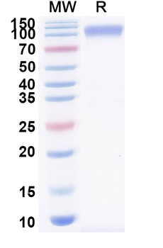 Recombinant Mouse CD172a/SIRPA Protein, C-Fc