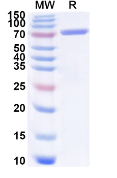 Recombinant Human FRS2 Protein, N-His