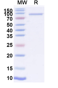 Recombinant CHIKV Spike glycoprotein E1 Protein, C-Fc