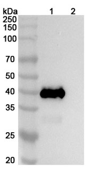 Recombinant CHIKV Spike glycoprotein E2 Protein, C-His