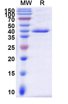 Recombinant CHIKV Spike glycoprotein E2 Protein, C-His