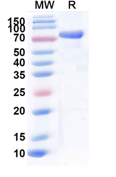 Recombinant CHIKV Spike glycoprotein E2 Protein, C-Fc