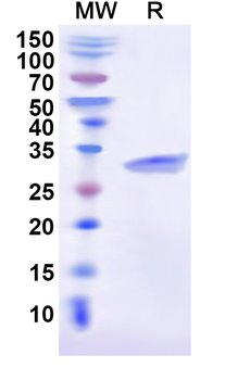 Recombinant Human USP30 Protein, N-His