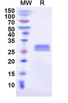 Recombinant Human USP4 Protein, N-His