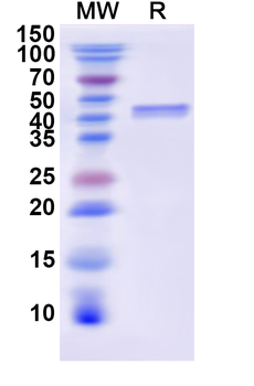 Recombinant Human CD25/IL2RA Protein, N-His-KSI