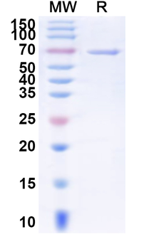 Recombinant Human DSG3 Protein, C-His