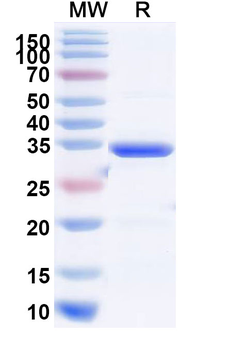 Recombinant Mouse Il11ra1/Etl-2/NR1 Protein, N-His