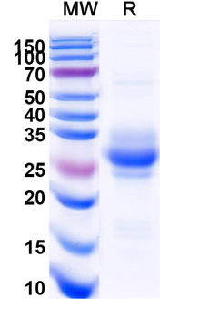 Recombinant Human TNFSF9/4-1BBL Protein, C-His