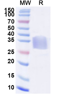 Recombinant Mouse CD47/IAP Protein, C-His