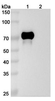 Recombinant Human AFP/Alpha-fetoprotein Protein, C-His