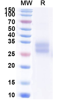 Recombinant Mouse CD137/TNFRSF9/4-1BB Protein, C-His