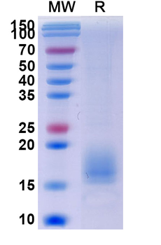 Recombinant Human ACVR1B Protein, C-His