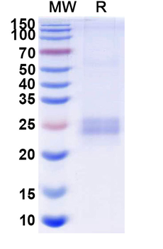 Recombinant Human CD252/TNFSF4/OX40L Protein, C-His