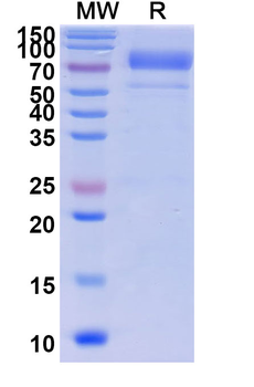 Recombinant Human PIVKA-II/DCP Protein, C-His