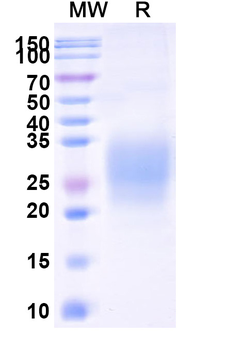 Recombinant Human CD314/KLRK1 Protein, C-His