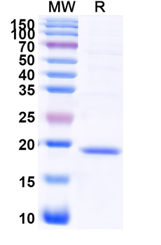 Recombinant Human RPL17 Protein, N-His