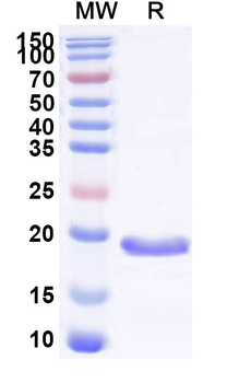 Recombinant Human GABARAP Protein, N-His