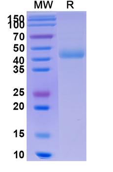 Recombinant Human CD172g/SIRPG Protein, C-His