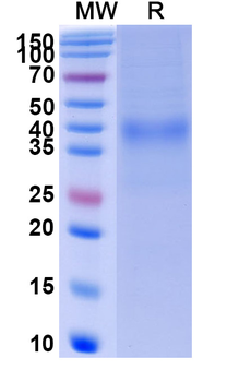Recombinant Human CD158d/KIR2DL4 Protein, C-His
